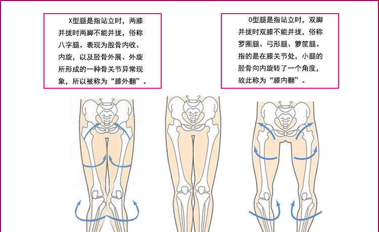 O型腿矫正